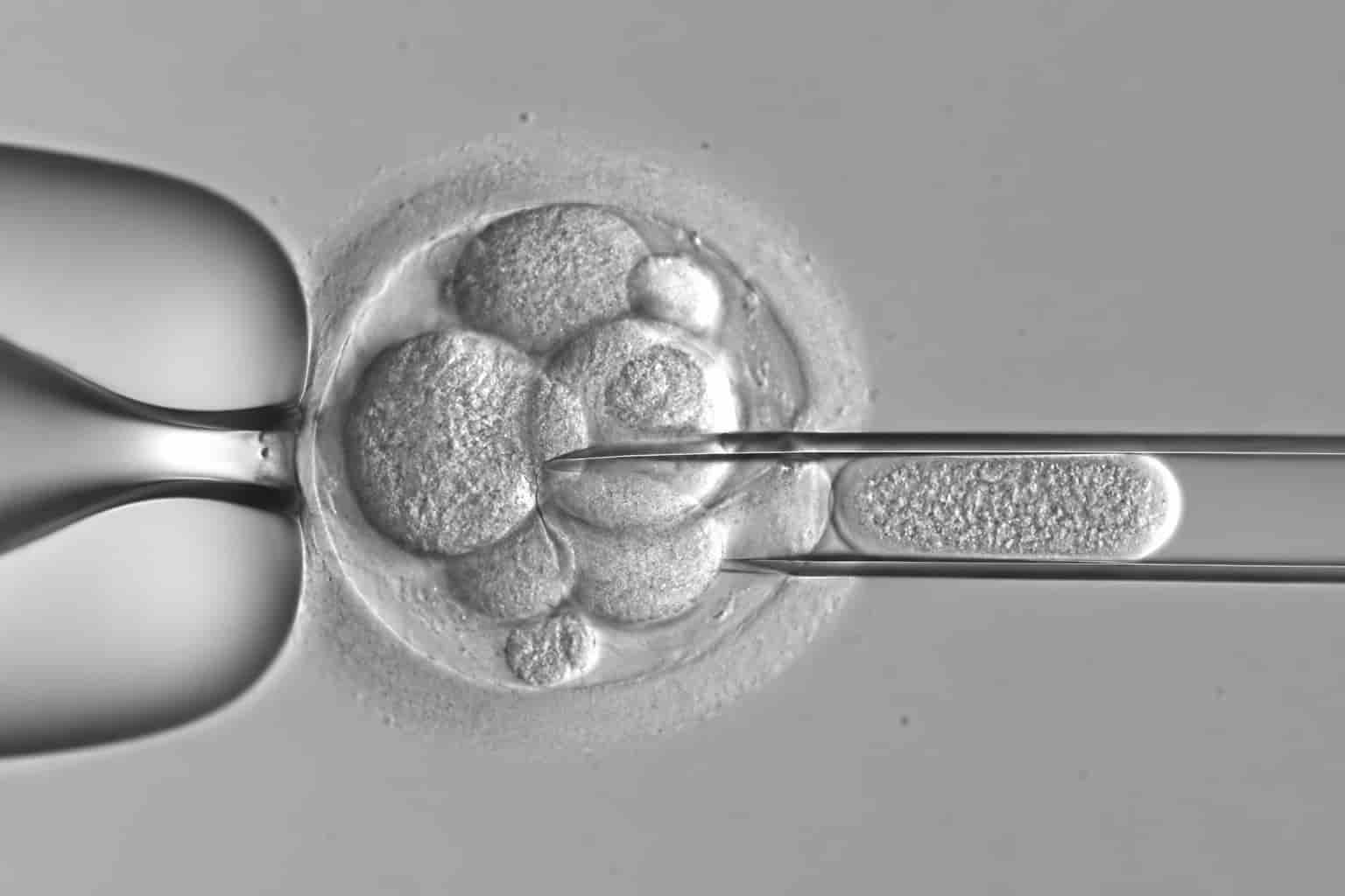 Yardımcı Üreme Teknikleri: Aşılama, Tüp Bebek (IVF), ICSI ve Embriyo Transferi
